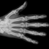 X-Ray Scanner v1.6 Unlocked – Troll chụp X quang cho Android